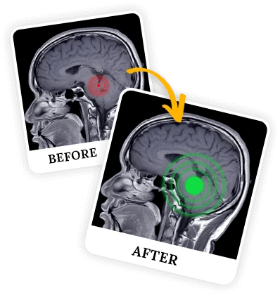 billionaire-brain-wave-programs